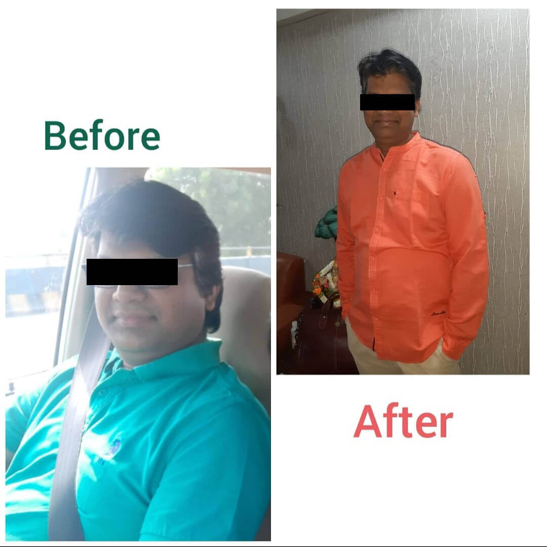 Thyroid Specialist in Bopal Ahmedabad