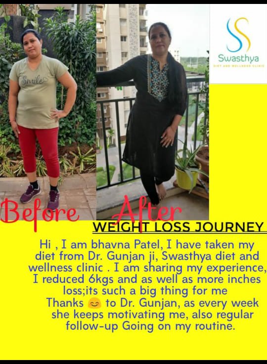 Hypertension Diet plan in Sarkhej Ahmedabad